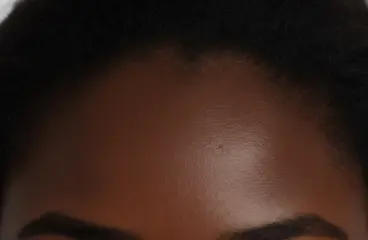 Medical Hair Systems